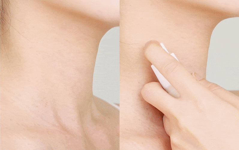 1_목 달라붙음 비교.gif