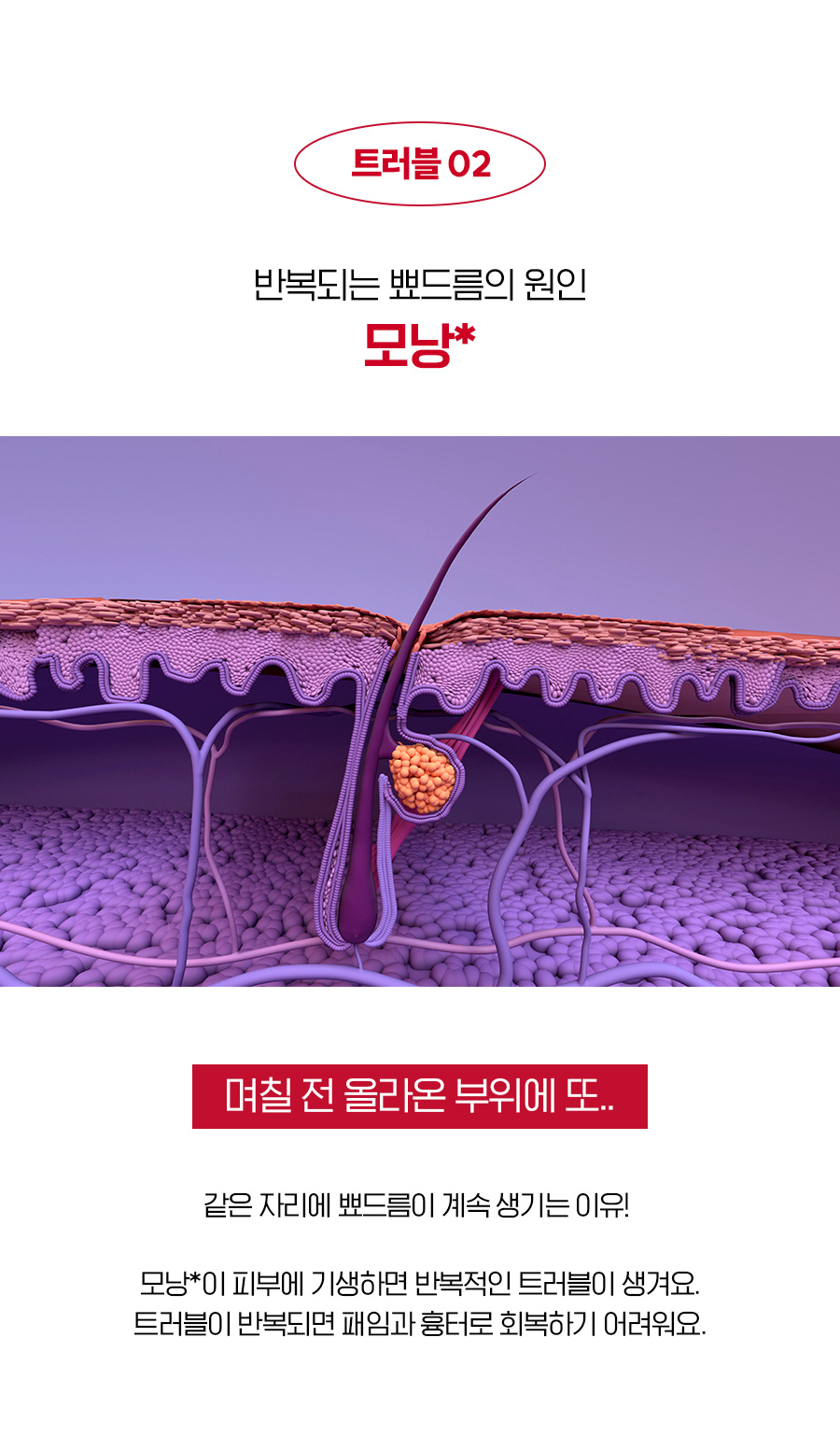 닥터알파_뾰드름팩_06.jpg