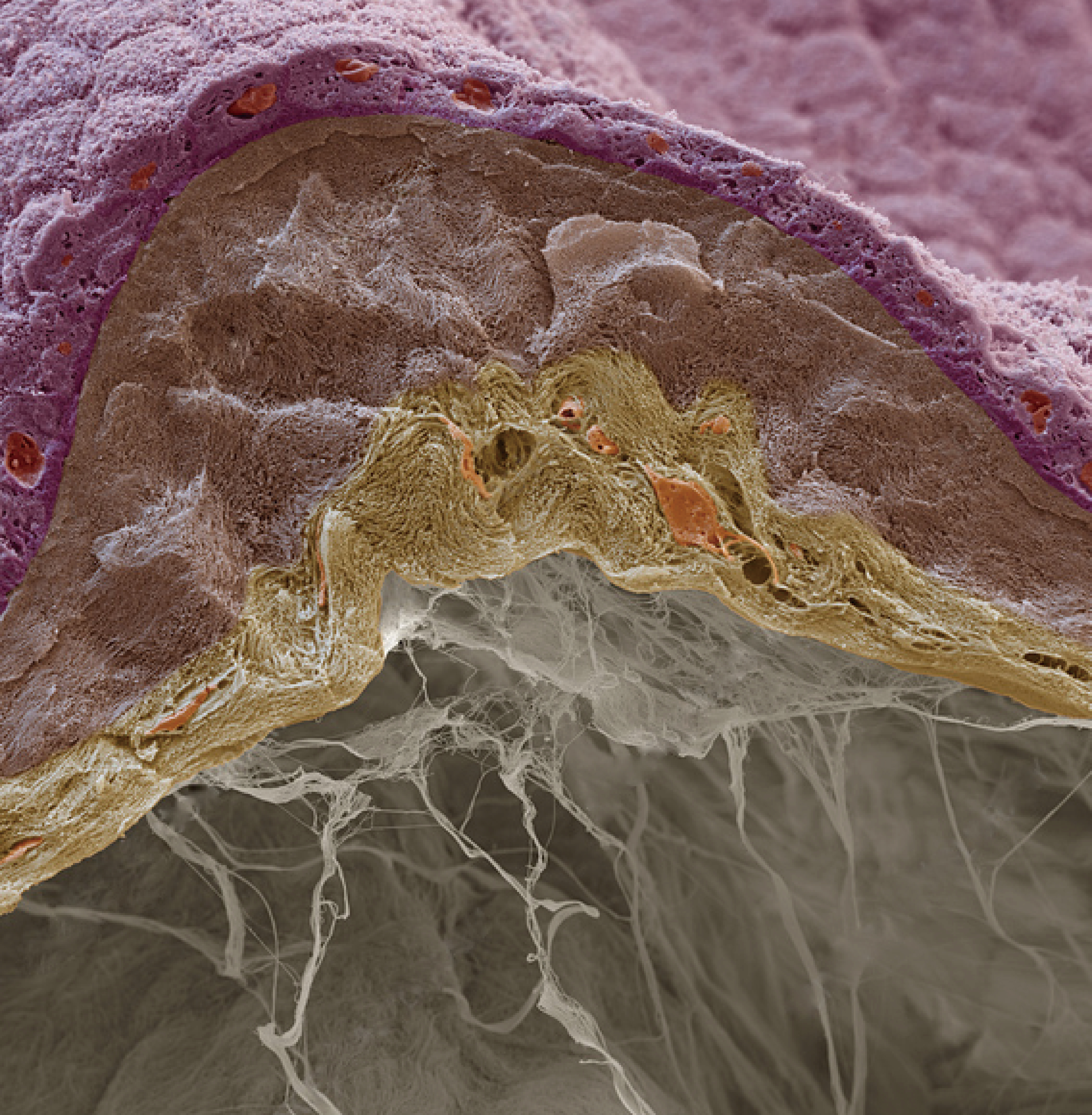 34세 이후 피부 색조정.jpg