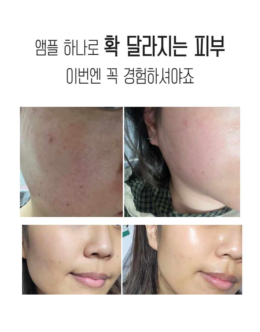 밤앰플작은탬플릿 (80).jpg