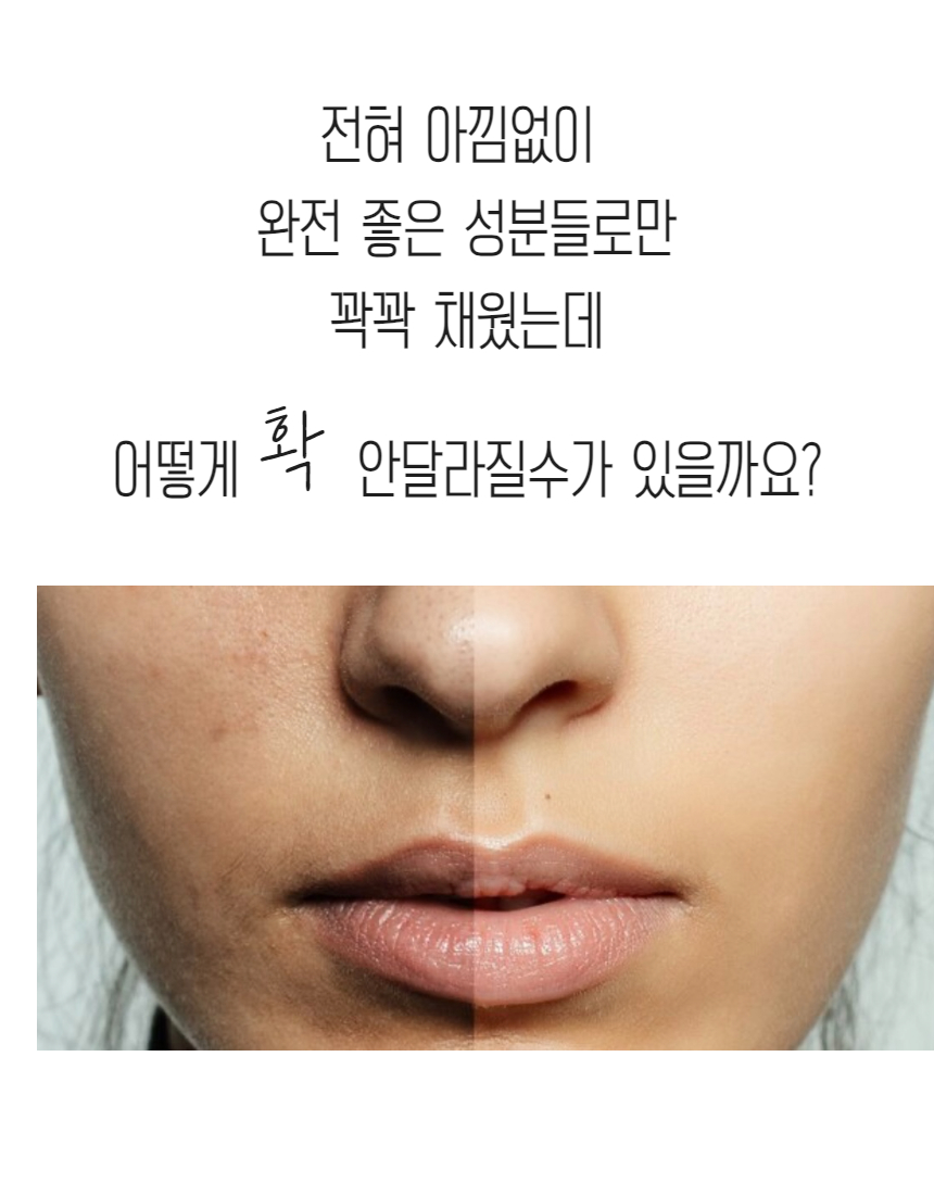 밤앰플작은탬플릿 (83).jpg