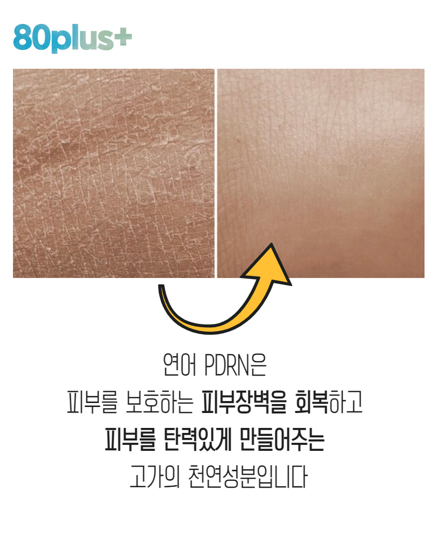 밤앰플작은탬플릿 - 2023-12-07T142220.563.jpg