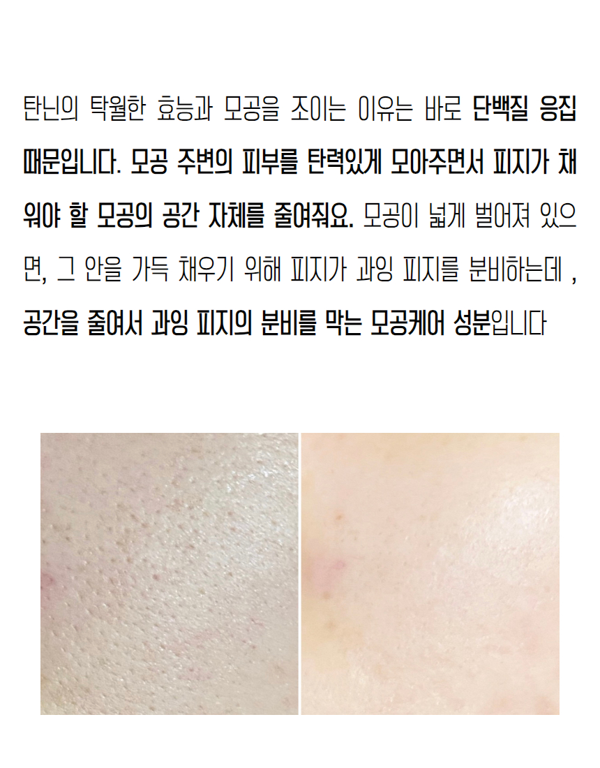 밤앰플작은탬플릿 - 2023-12-07T141312.692.jpg