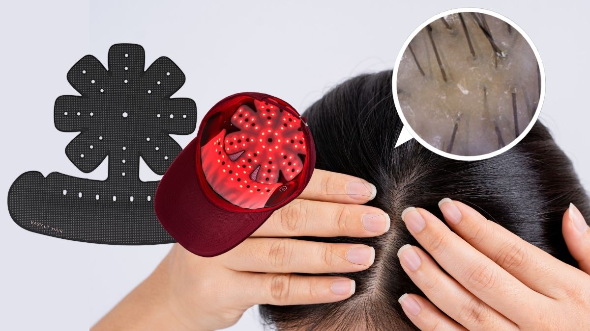 10년차 탈모커뮤니티 이마반도 인정한 두피 관리기 '끝판왕'<이지엘헤어>