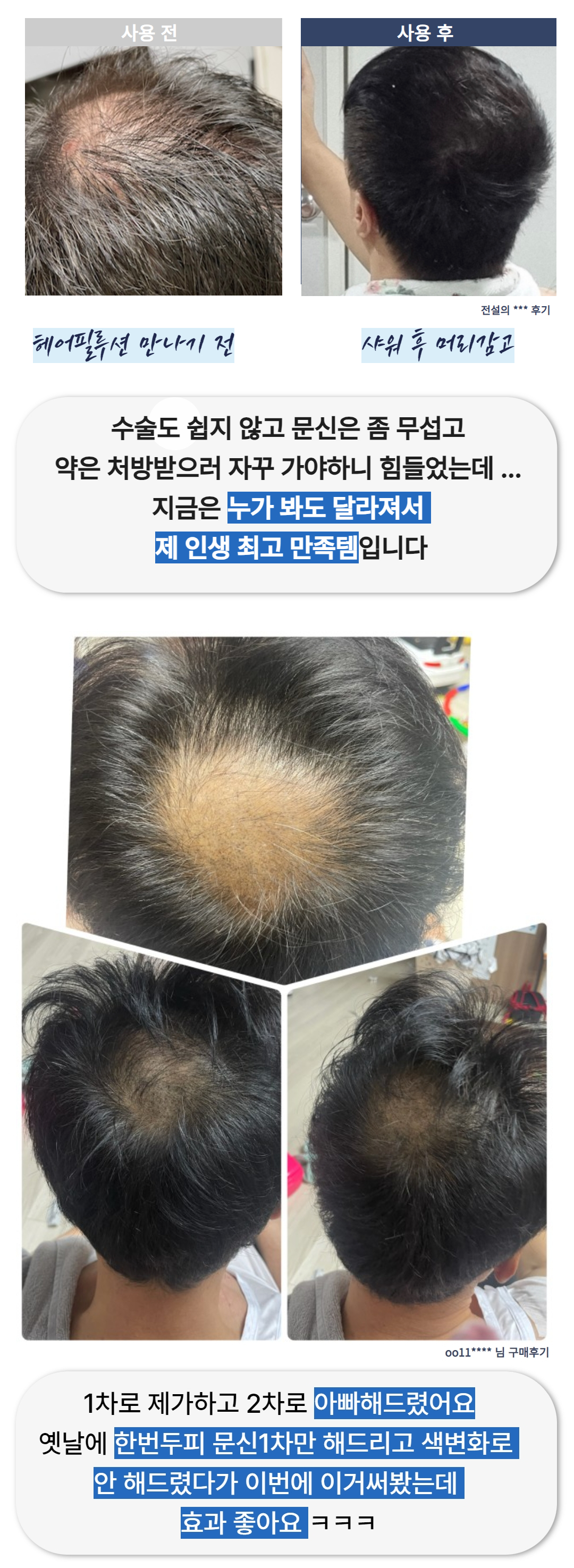 멕시멈 후기 비포&에프터.jpg