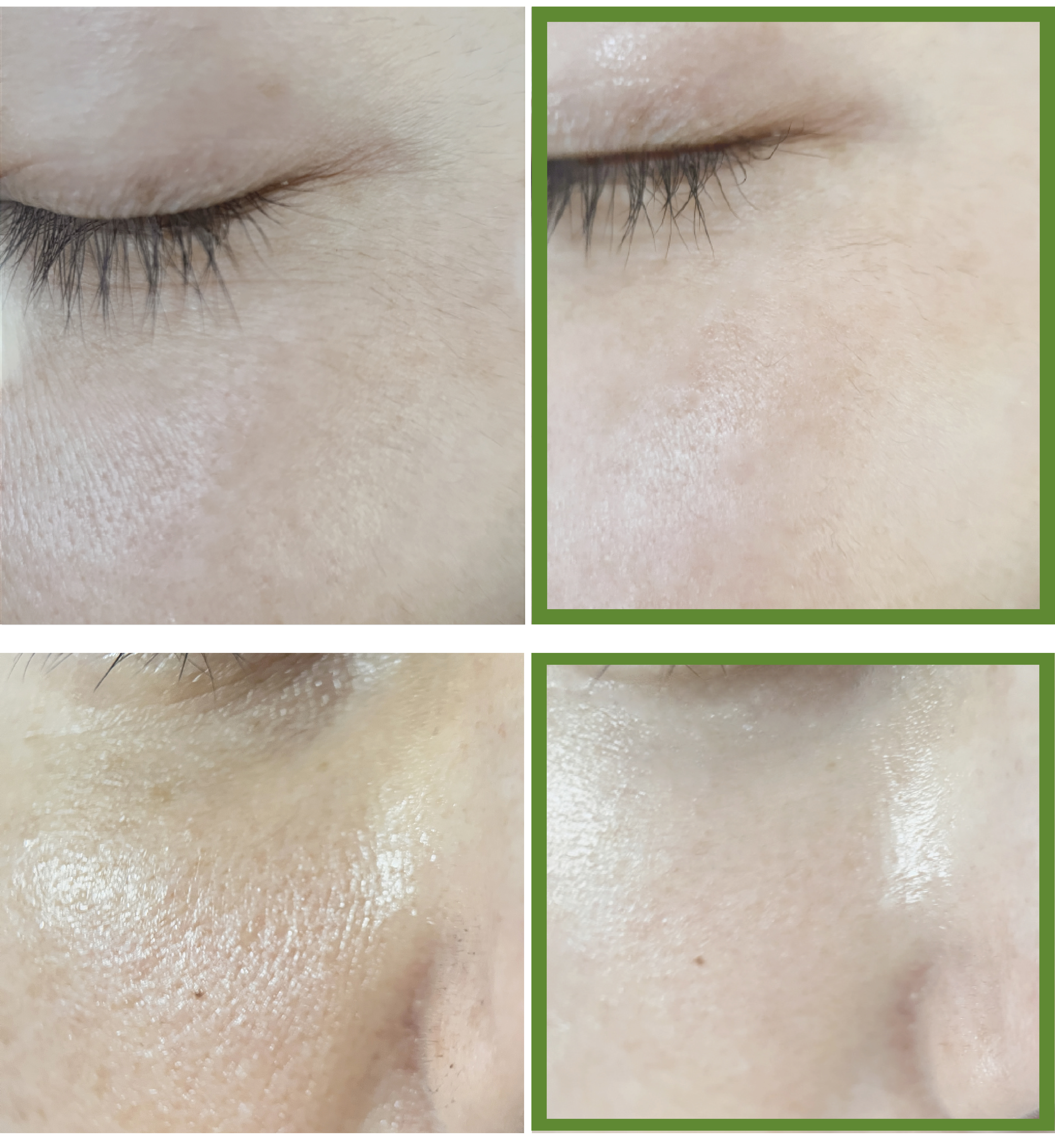 [최종]8_꿀동안 상세페이지-19.jpg