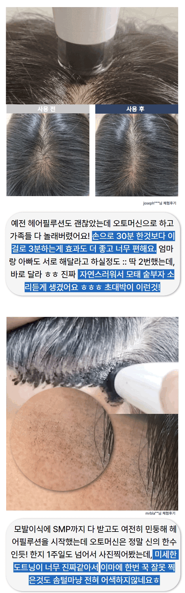 [복사본] 멕시멈비포에프터-메디톡샷 (2).gif