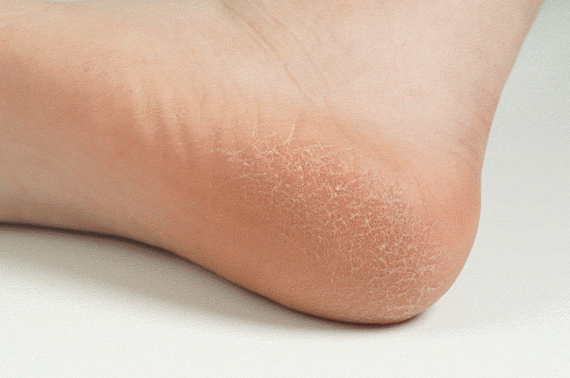 14.gif