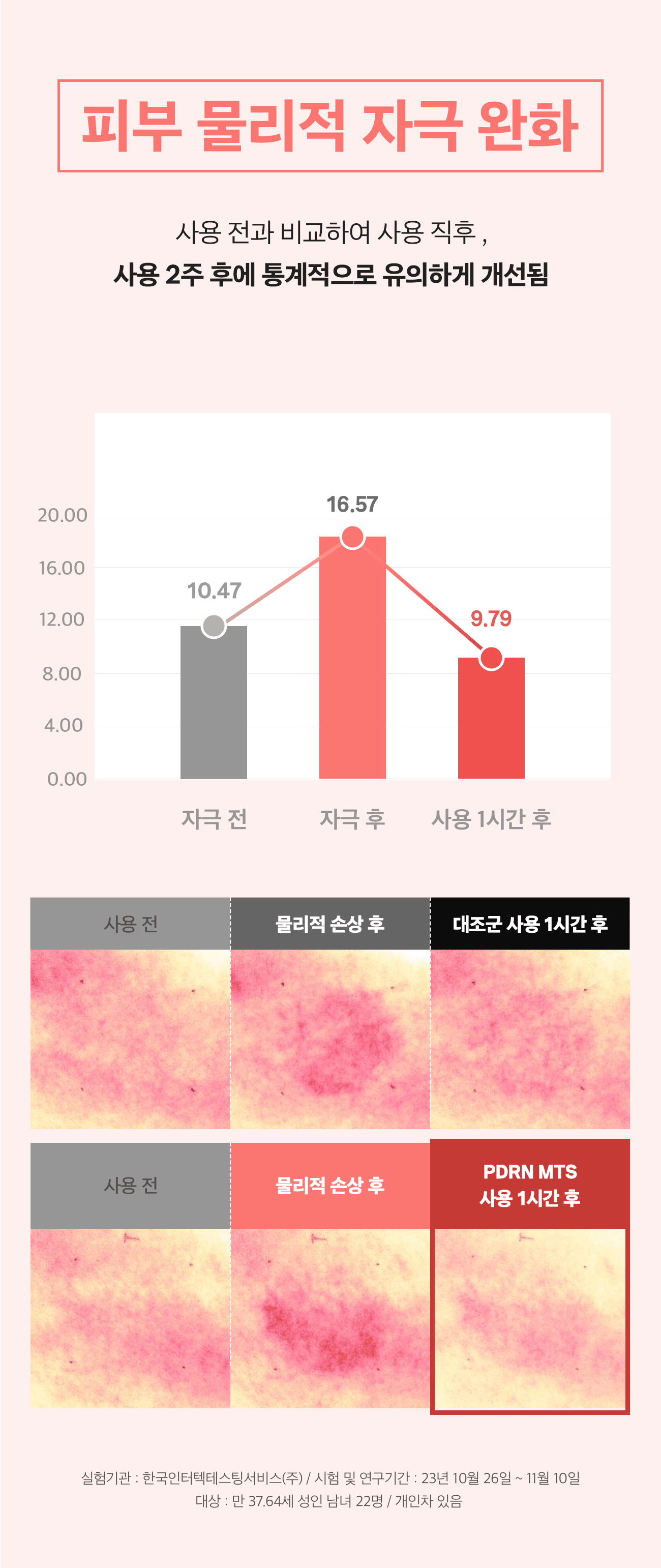 41-3 물리적자극완화.jpg