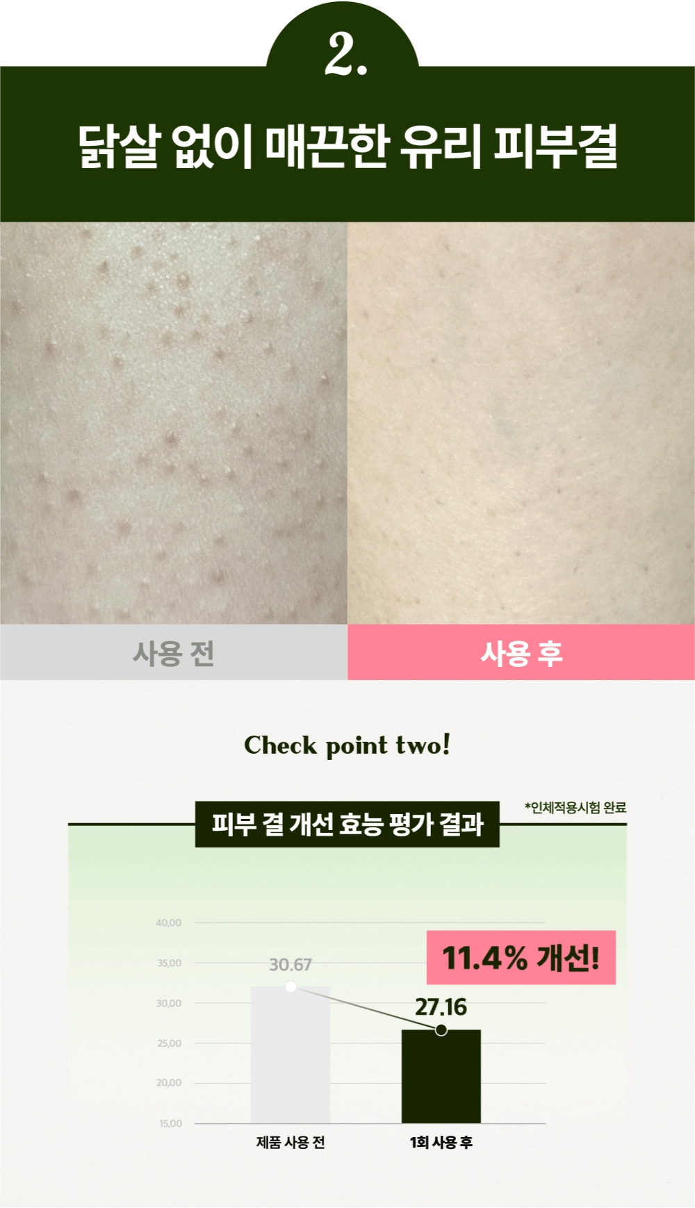 임상 2번.gif