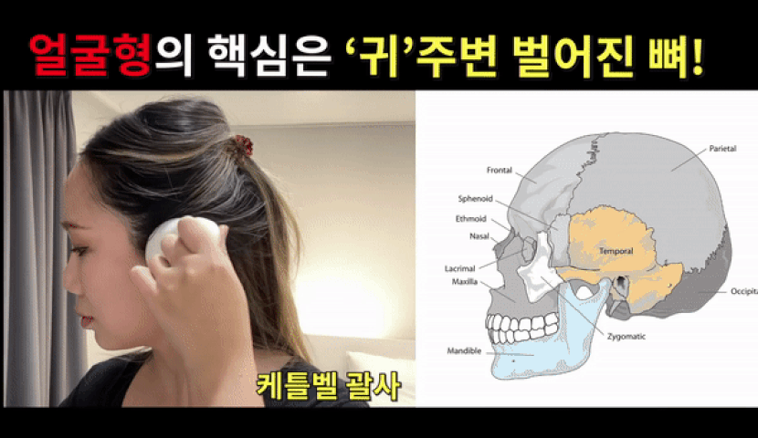 2mb_귀_케틀 단독.gif