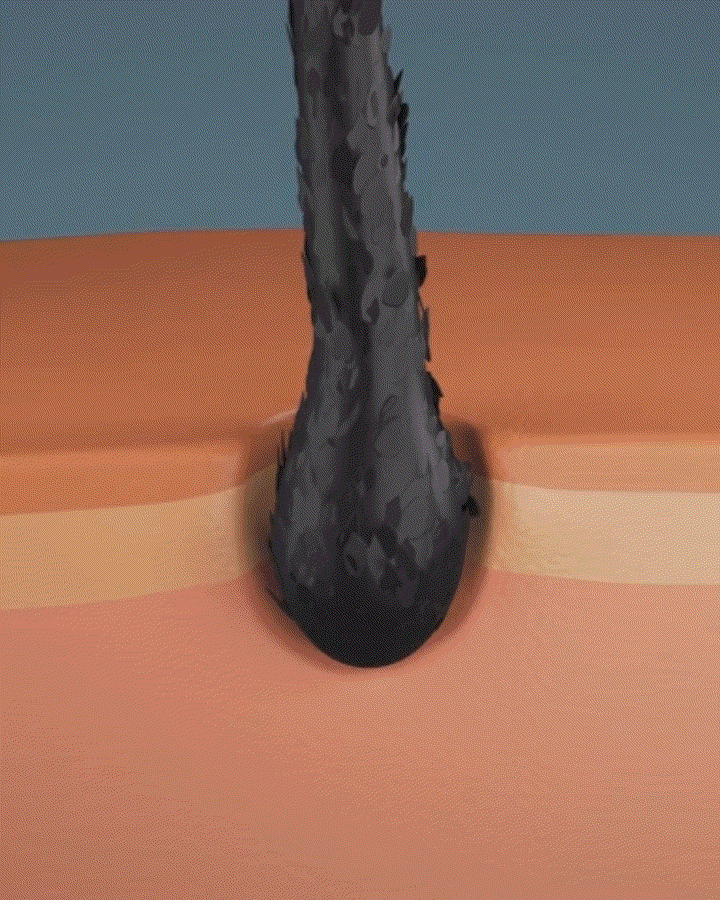 모발 영양 gif.gif