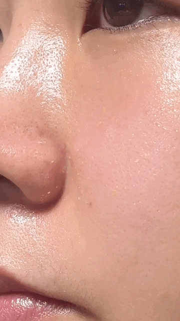 피지가 맺혀있는.gif
