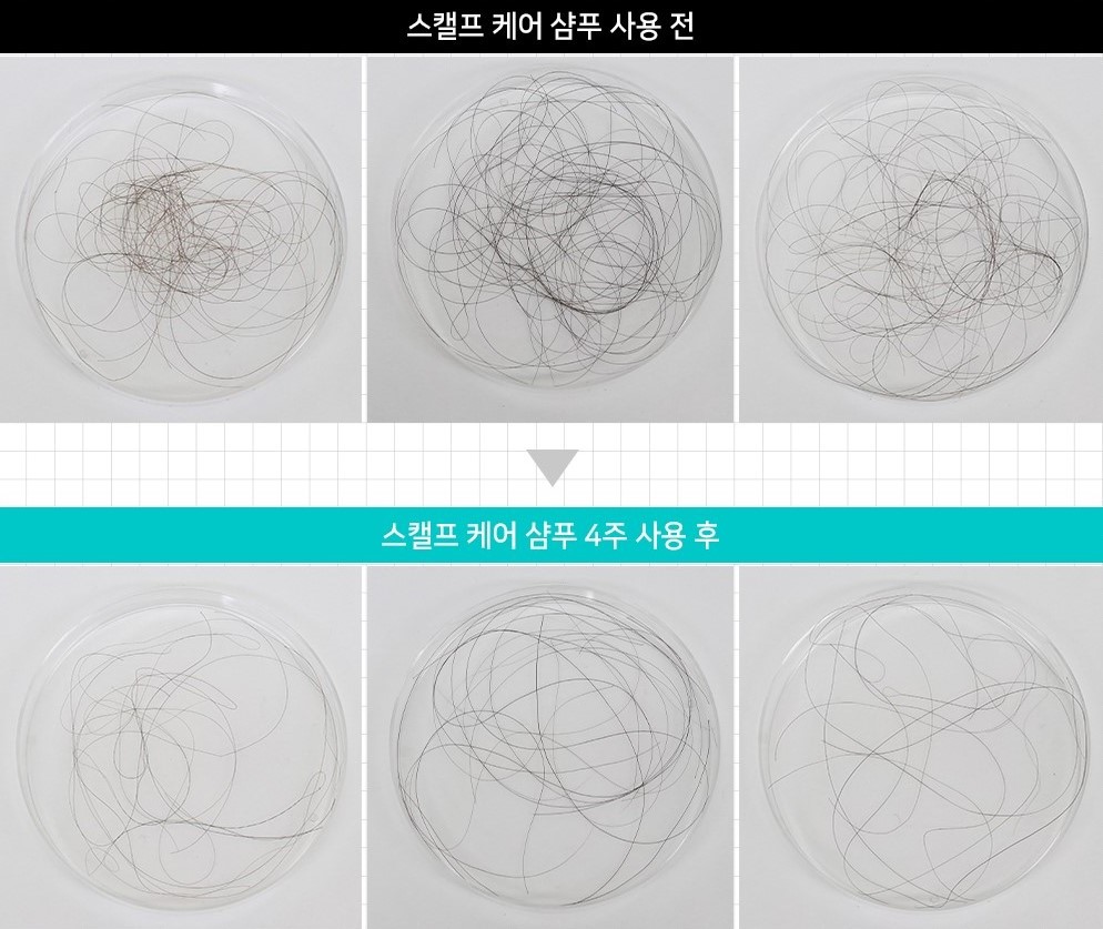 크게 샴푸_상세페이지_임상시험 (1)모발 탈락수감소.jpg