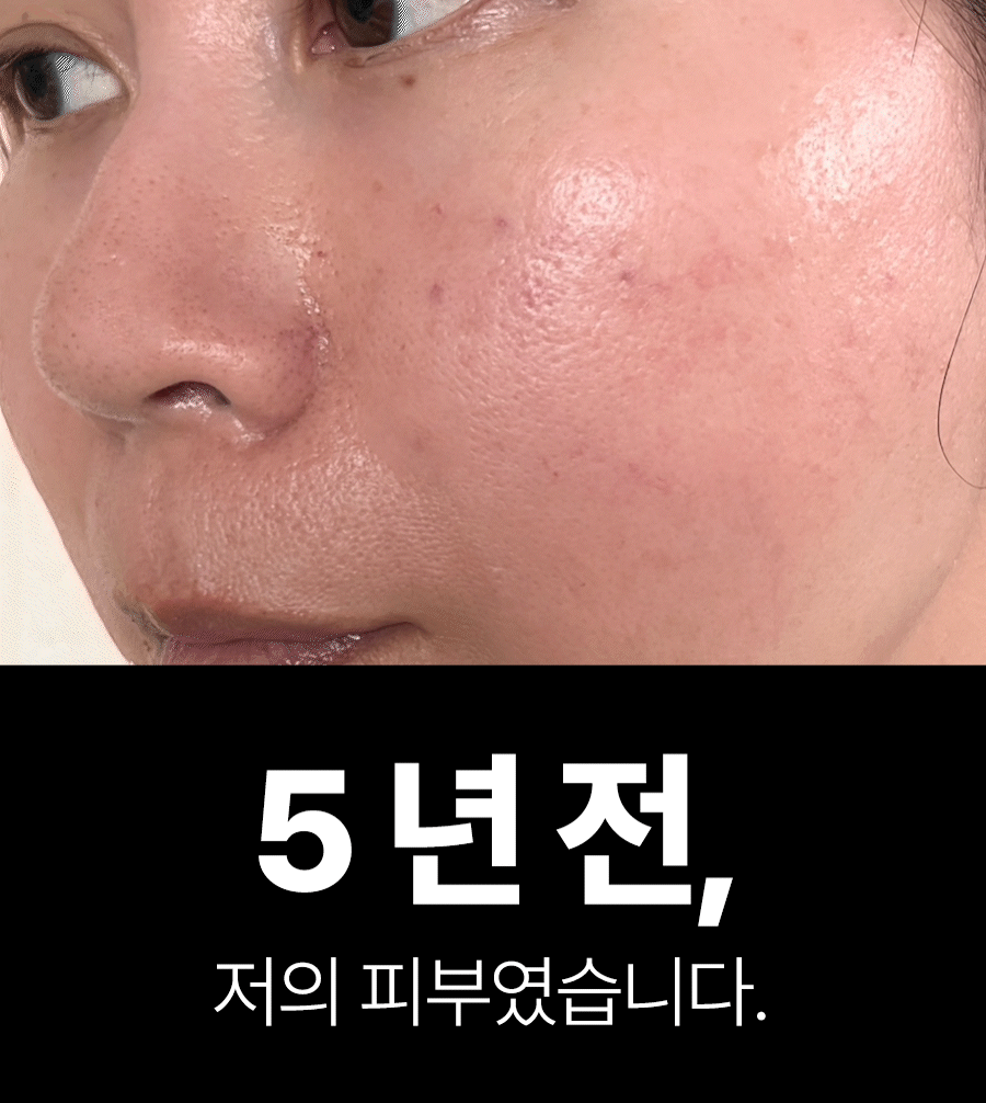 New비포사진확대.gif