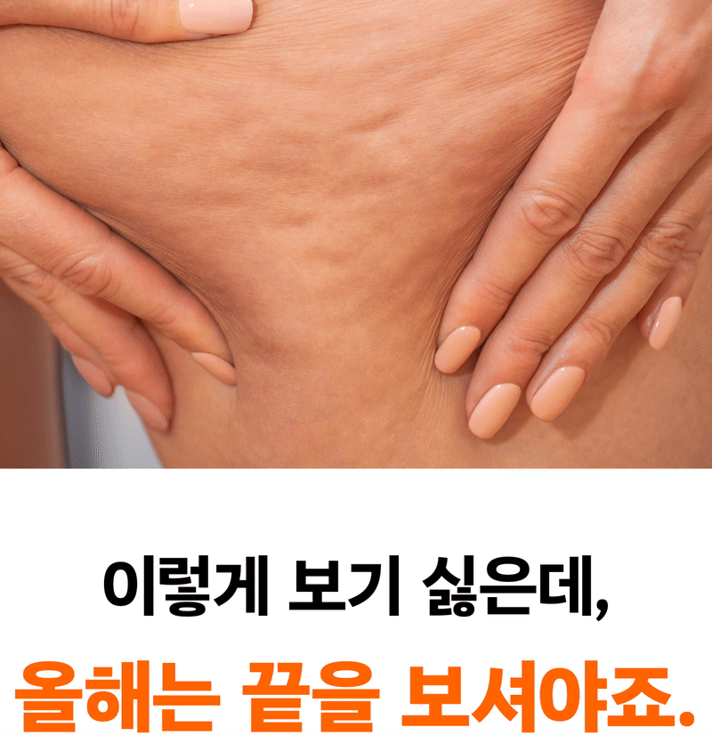 메드라인_셀룰크림-03.jpg