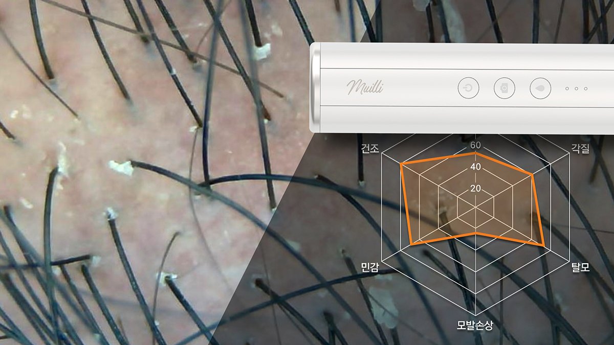 知らずにするケアはケアじゃない [AIカスタム頭皮ケアプロジェクト]