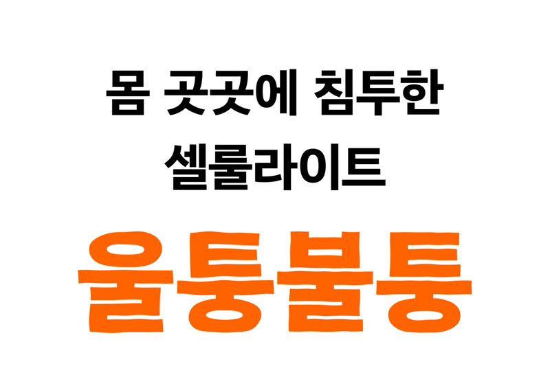 메드라인_셀룰크림-02.jpg
