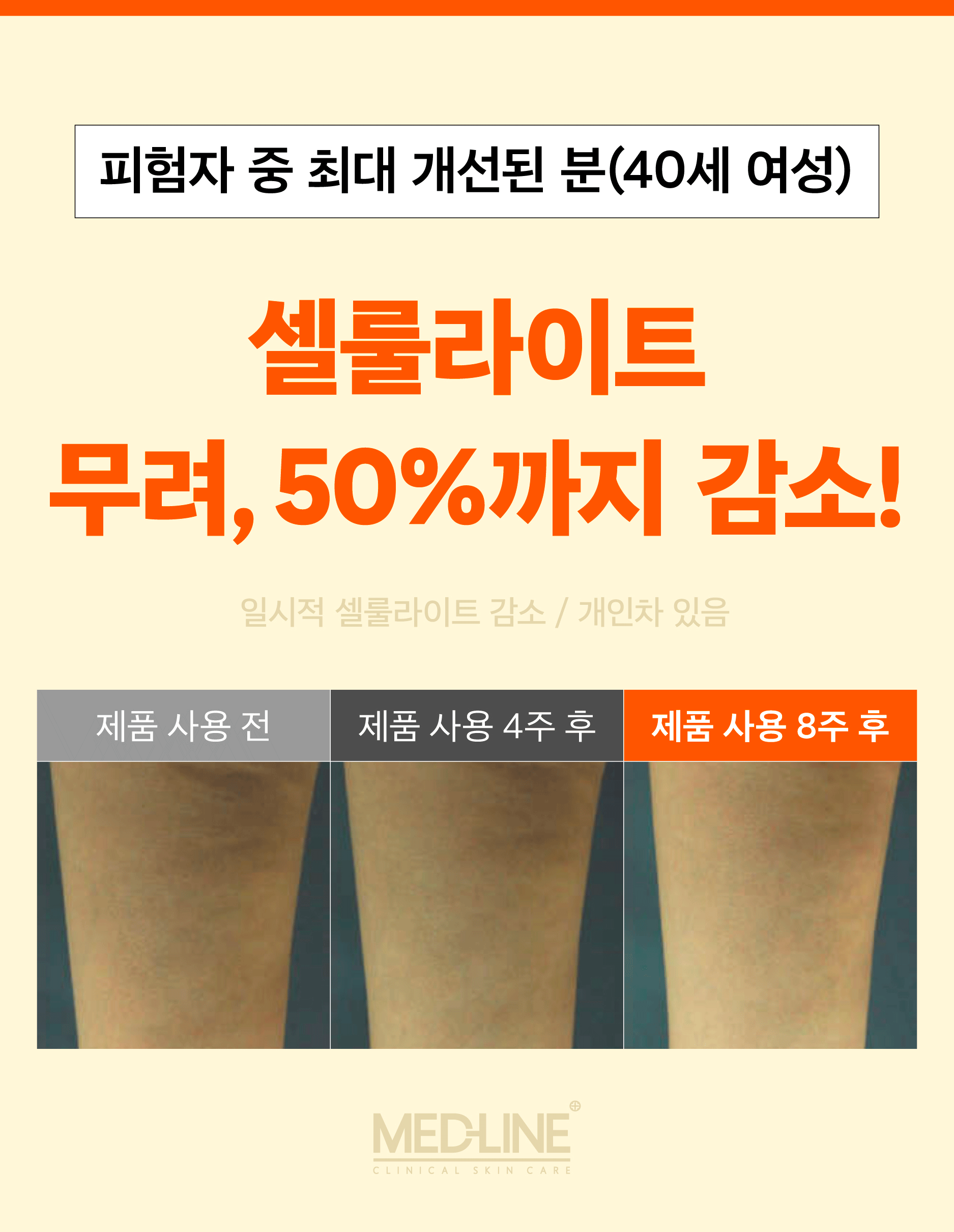 메드라인_셀룰크림(최종)-07.jpg