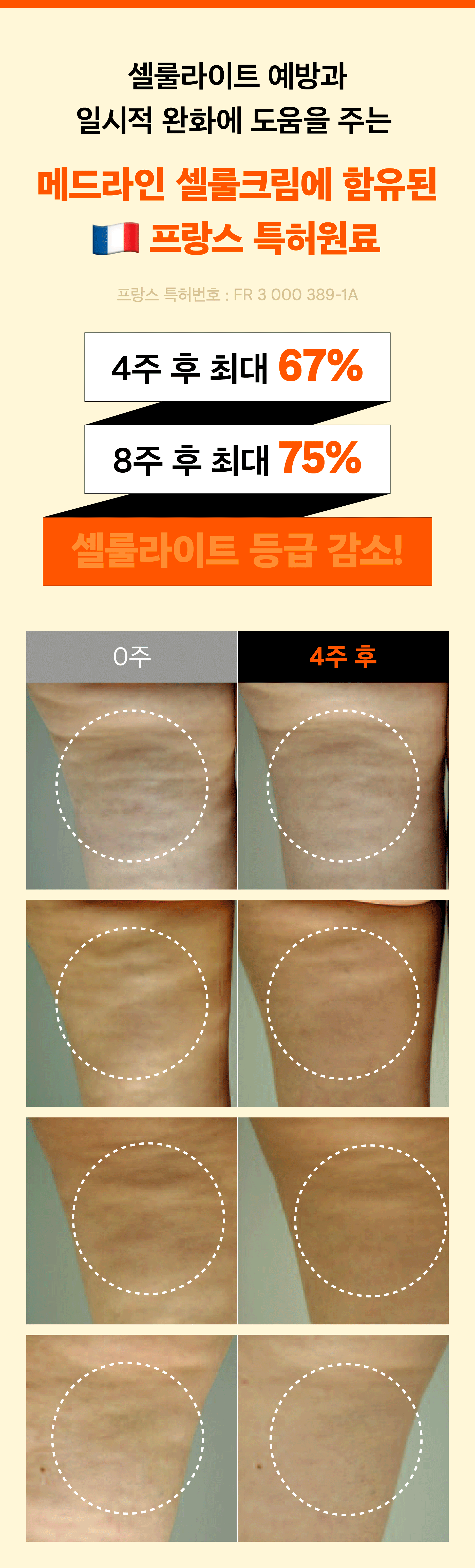 셀룰라이트등급감소_추가(수정).gif