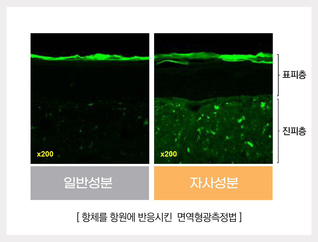 진피표피.jpg