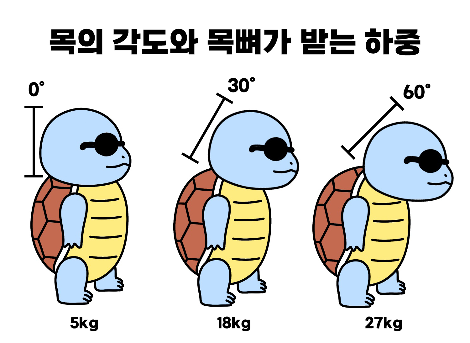 거북목 사진 2.jpeg