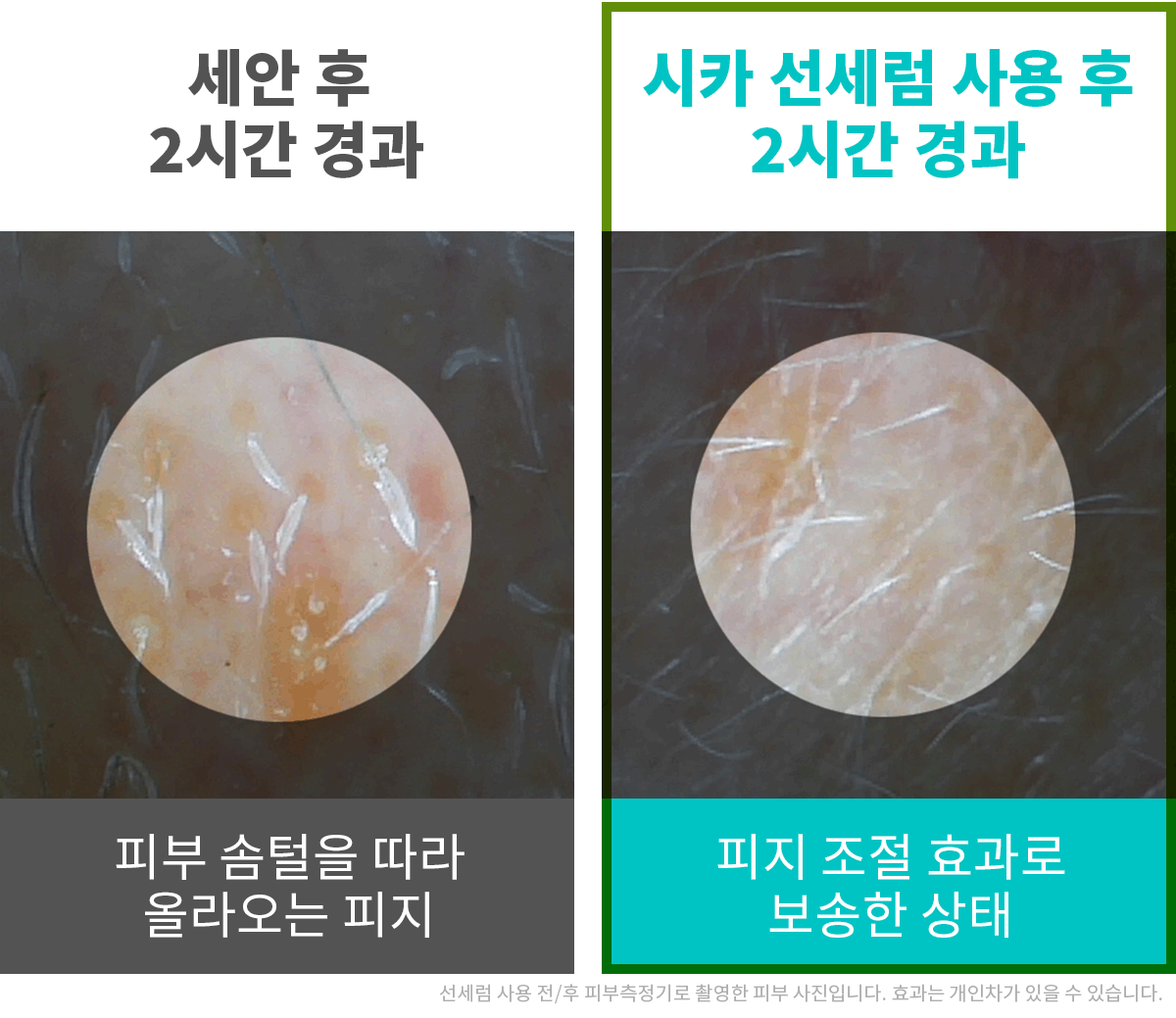 피지테스트.gif