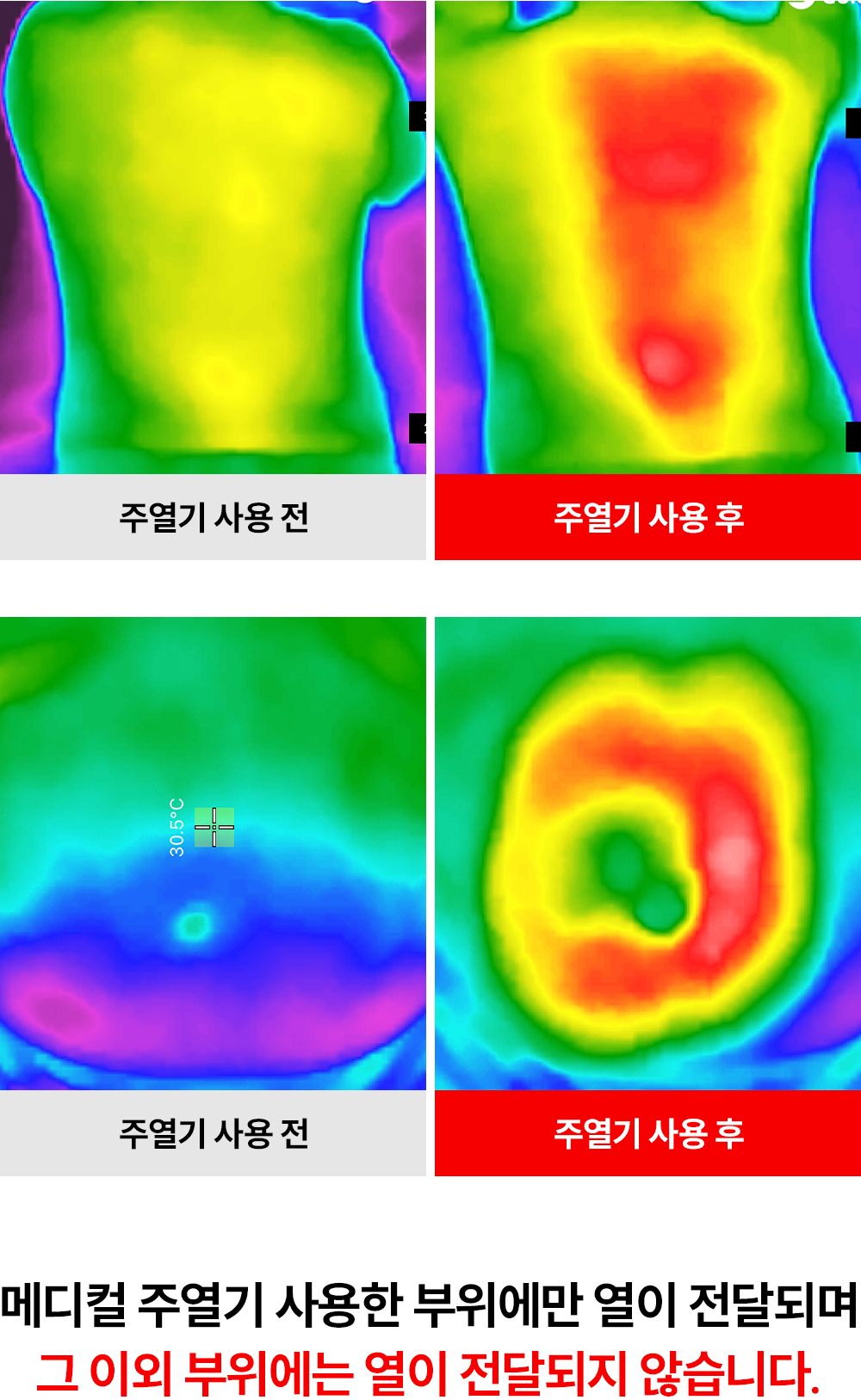 [그린인월드]주열찜질기_07-1-5-3.jpg