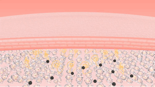 KakaoTalk_20240307_101010647.gif
