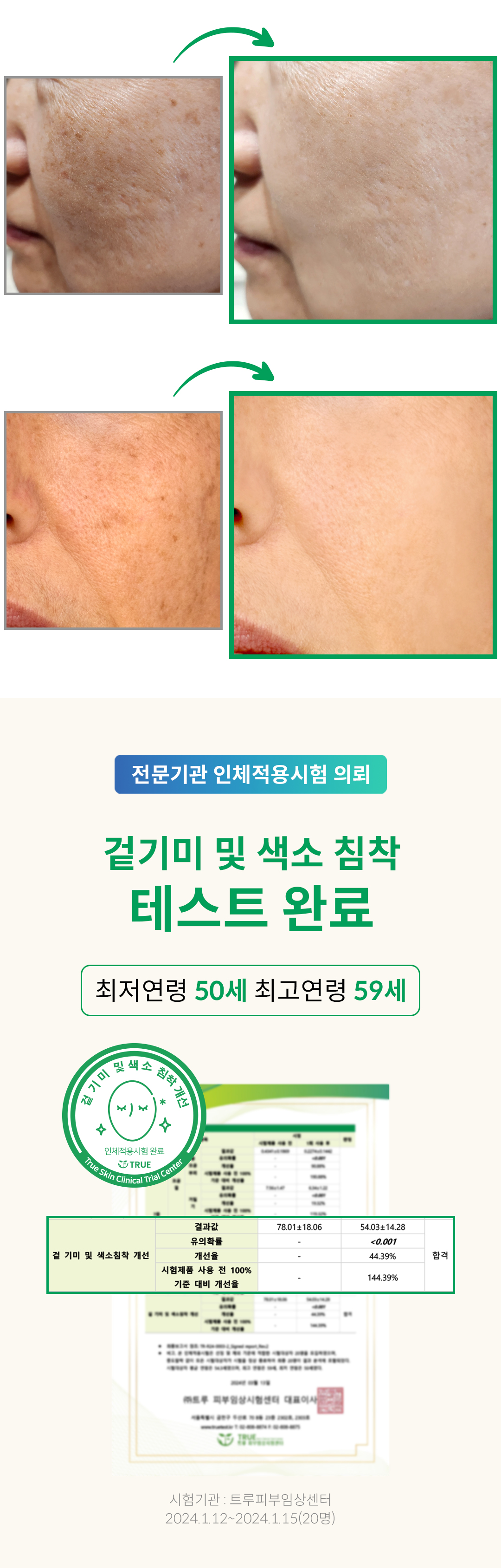 1020실크앰플_13겉기미임상.jpg
