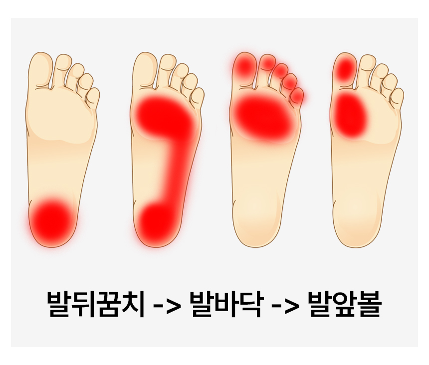 발바닥.jpg