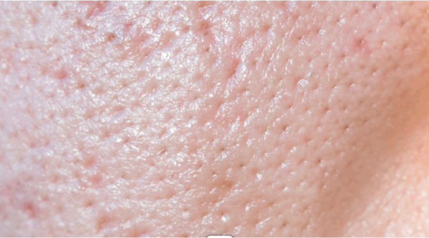 12dcc789-5b80-4ef6-87e9-a1601e20f36e.gif