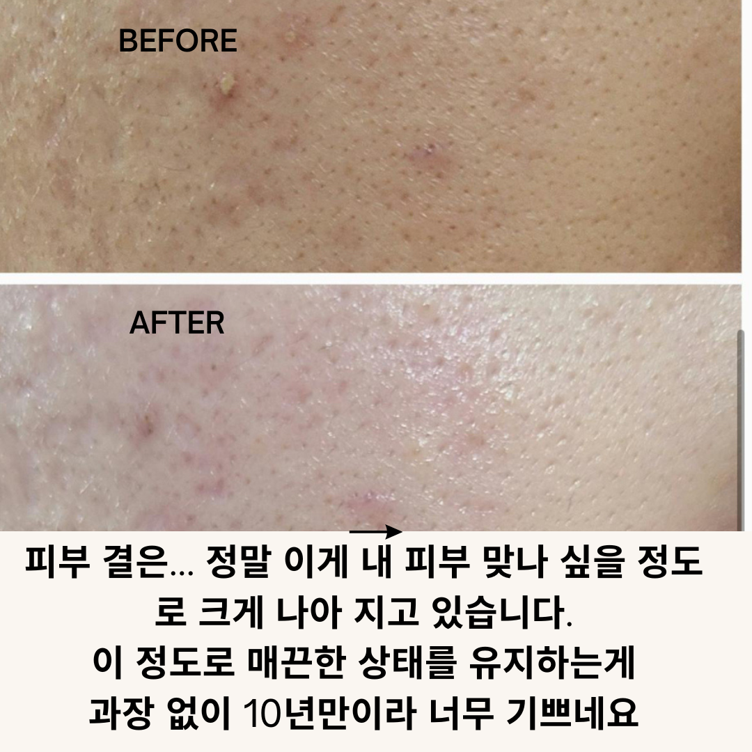 Beige Minimalist Skincare Before and After Instagram Post.png