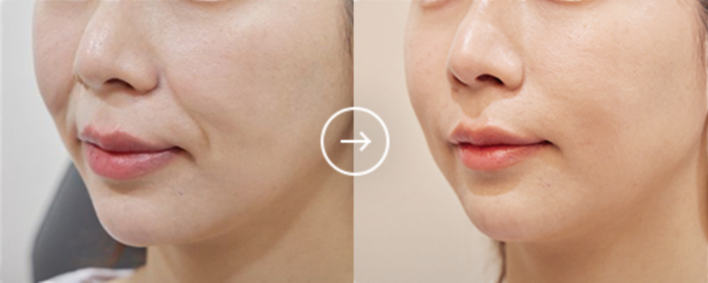 EOA_BA_이미지 5.png