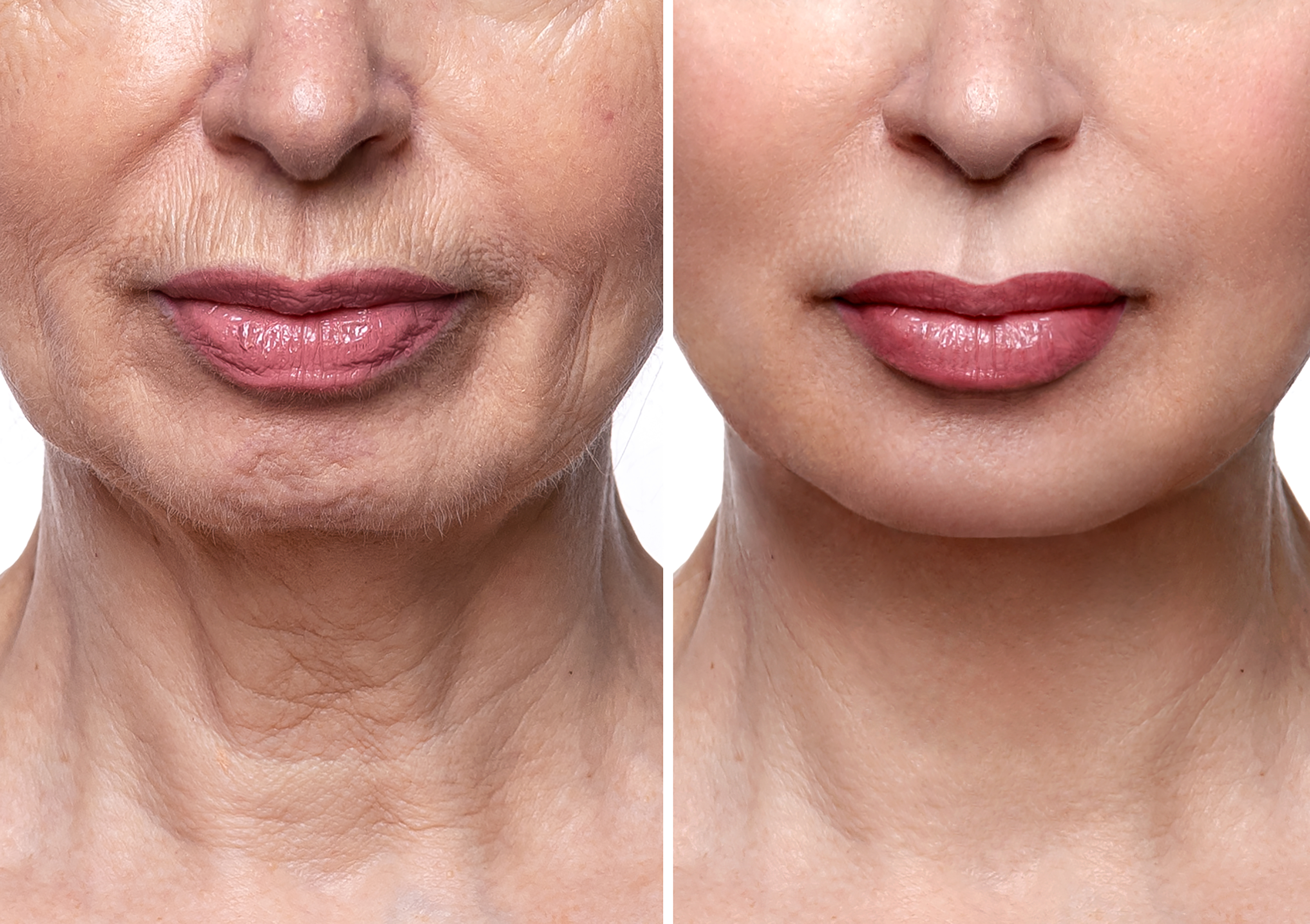 노화이미지 (6).jpg