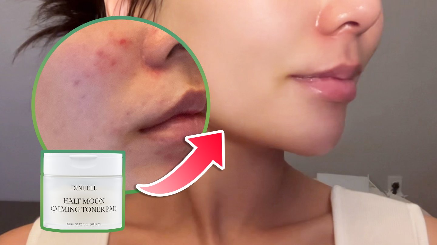 [Clinically Tested on 6 Points] One Use Cuts Dead Skin by 52%! Soothing & Exfoliating Together!