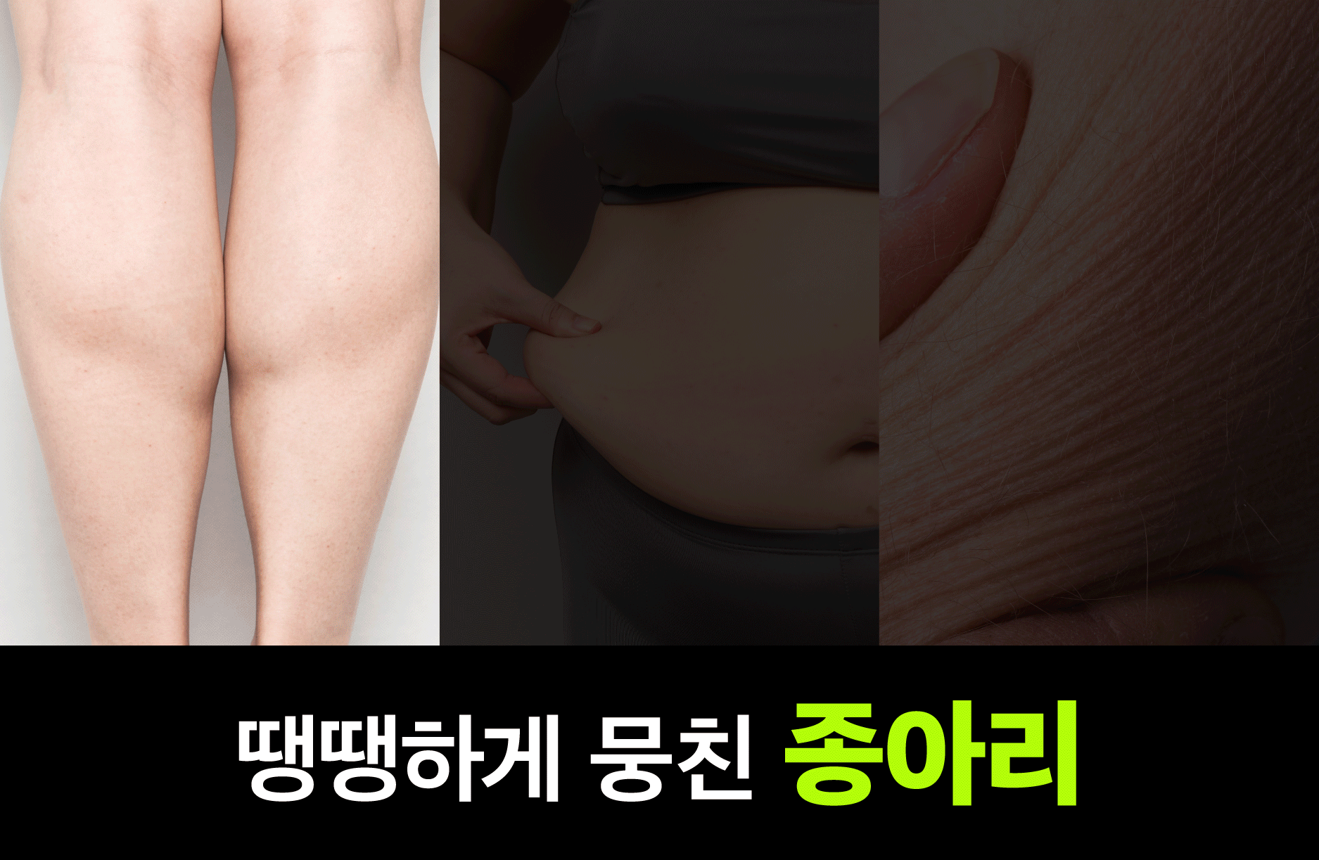 종아리알크림앵콜_3.jpg