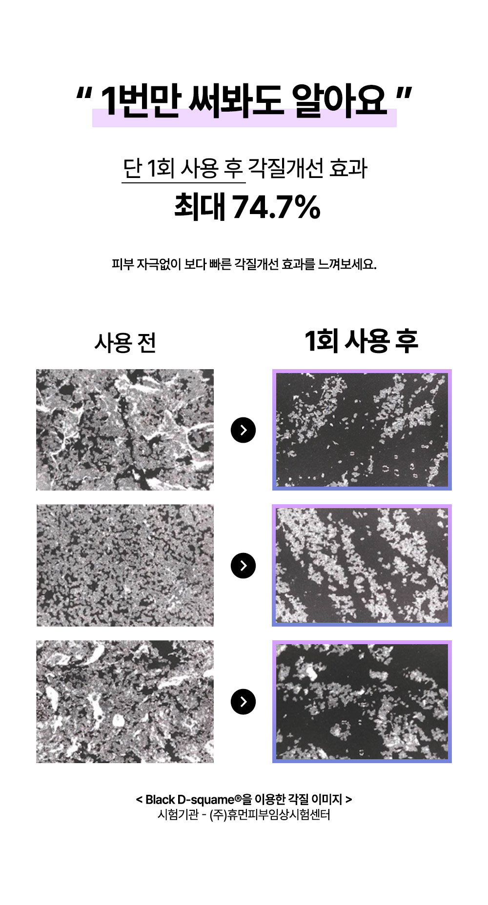 필-부스터-각질개선-테스트-추가_240327.jpg