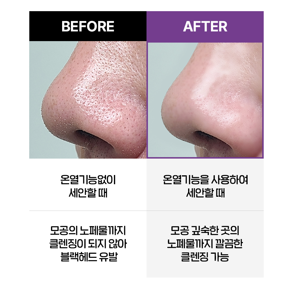 이미지 설명이 없습니다.
