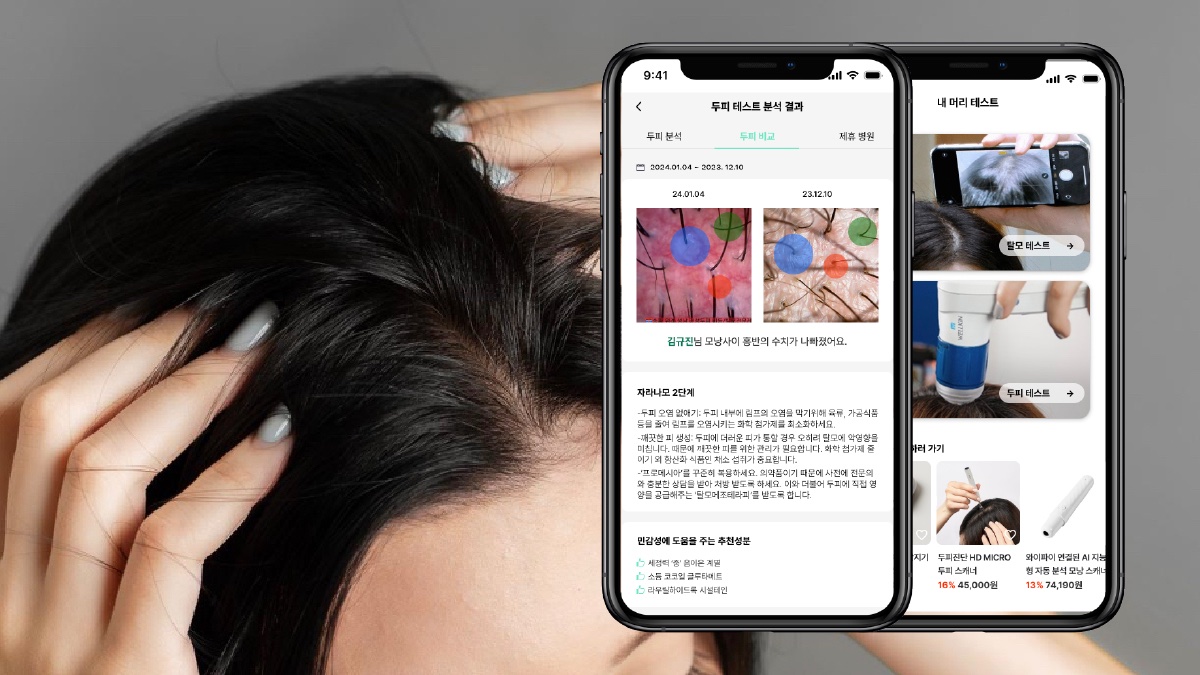 [5초 분석 케어] 내가 탈모?! 빅데이터가 말해주는 당신의 두피 상태!