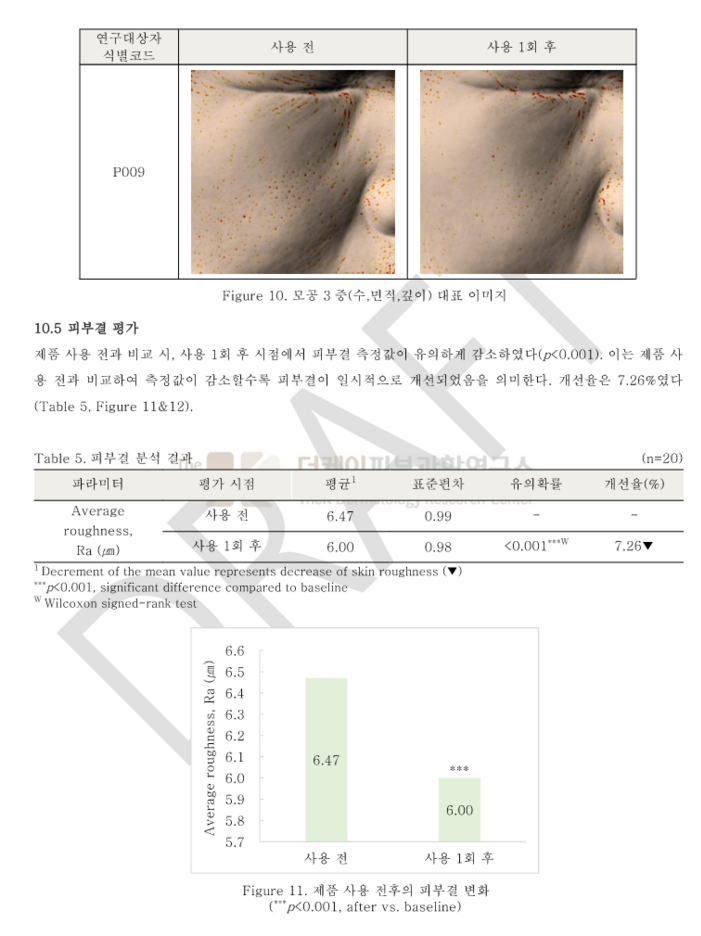 모공사진 및 피부결.png