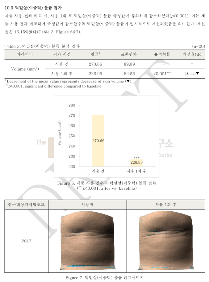 턱밑살.png