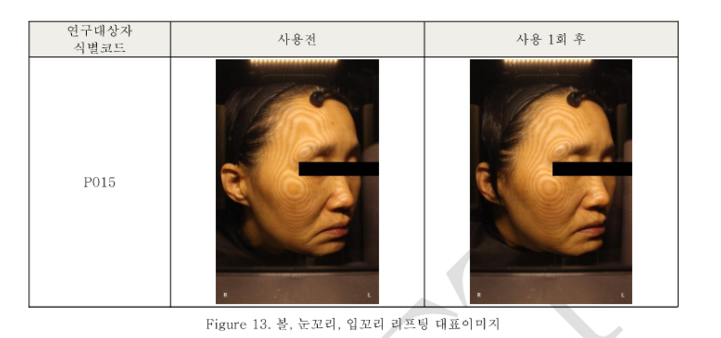 볼, 눈꼬리, 입꼬리 사진.png