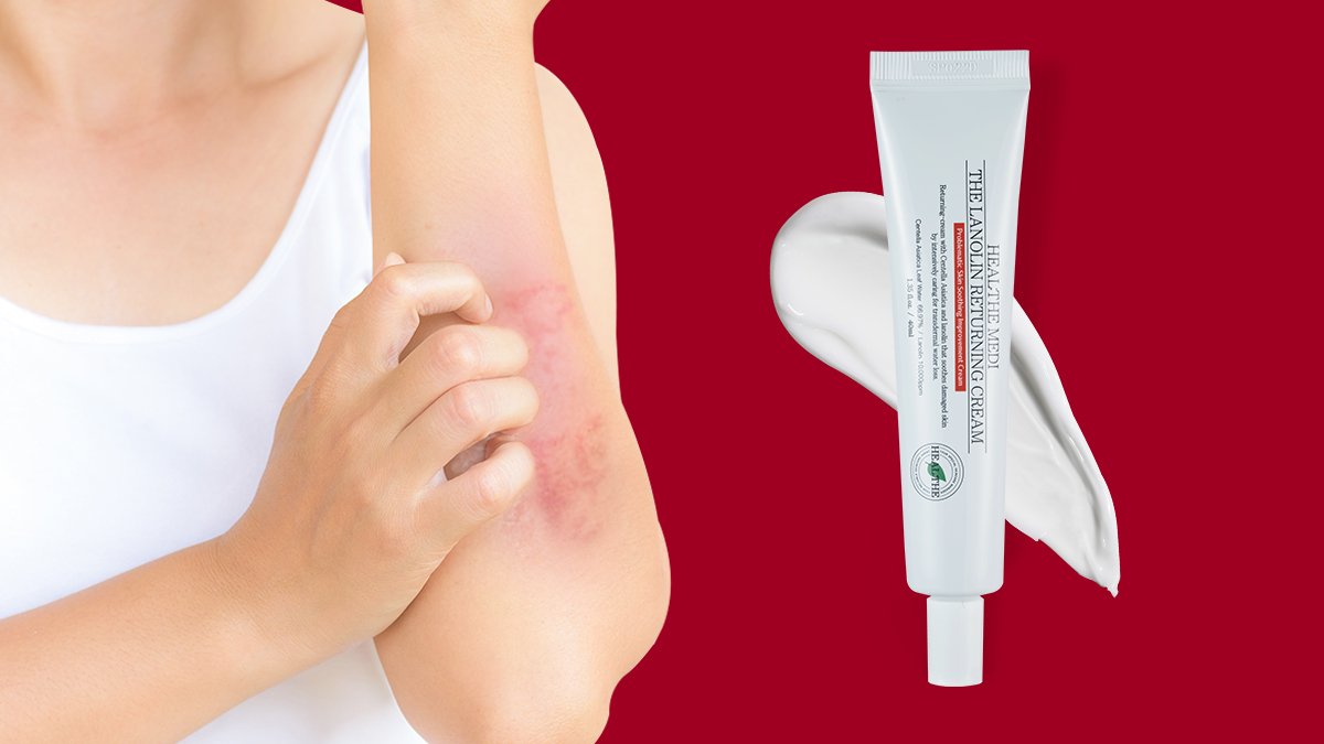 가려움개선 91.96%, 2080개 후기가 증명하는 시카라놀린 크림