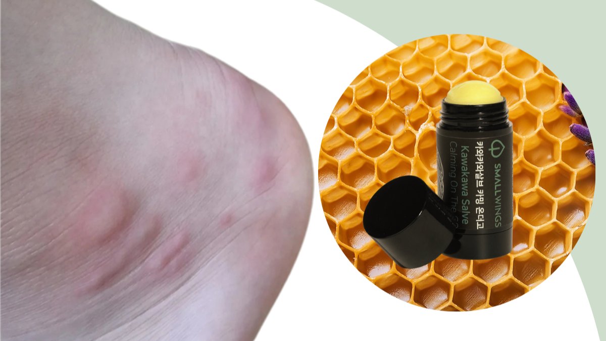 [容量升级！]提前备战蚊虫大战！今年夏天比往年更长~