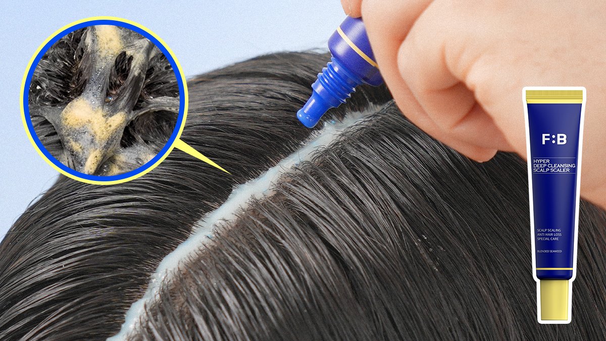 [두피스케일러] 각질 폭탄, 가려움 지옥! 단, "한번"만에 두피청소 끝