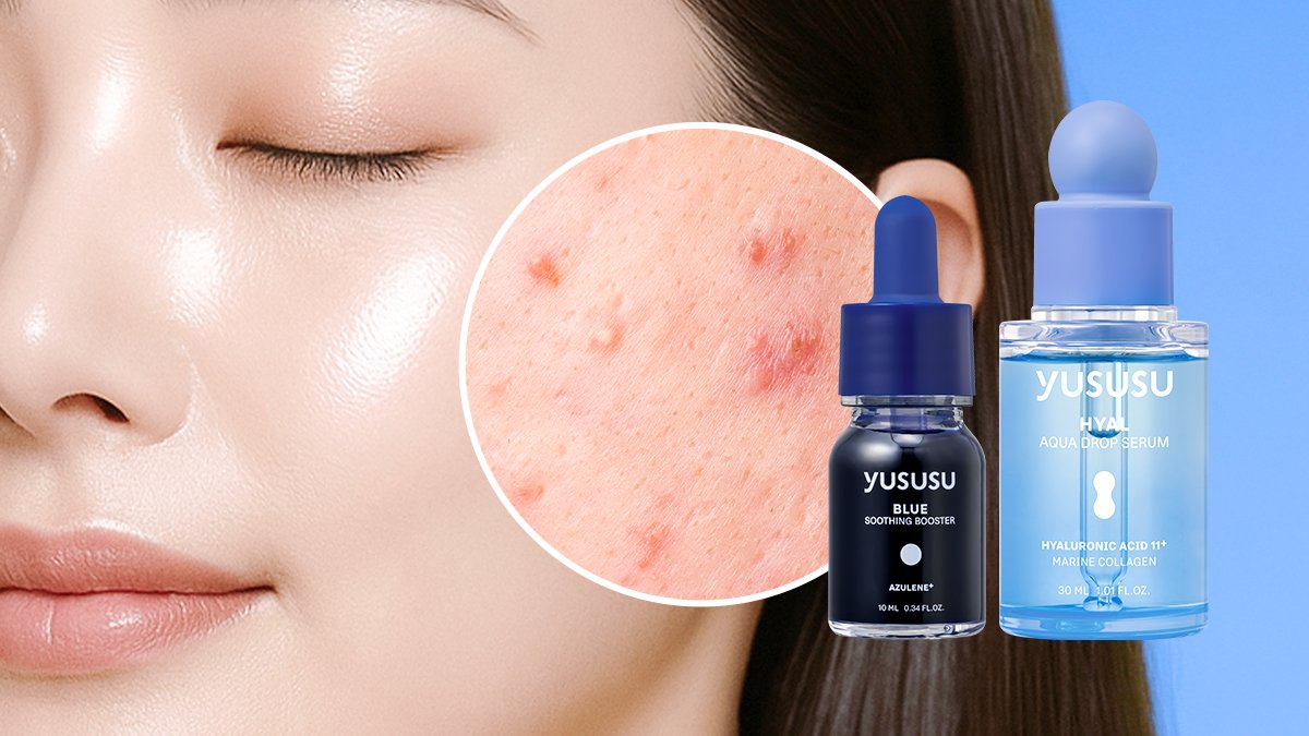 肌肤问题·发热感·内在干燥？仅需3滴即可解决，完全复刻皮肤科焕肤精华的原理！