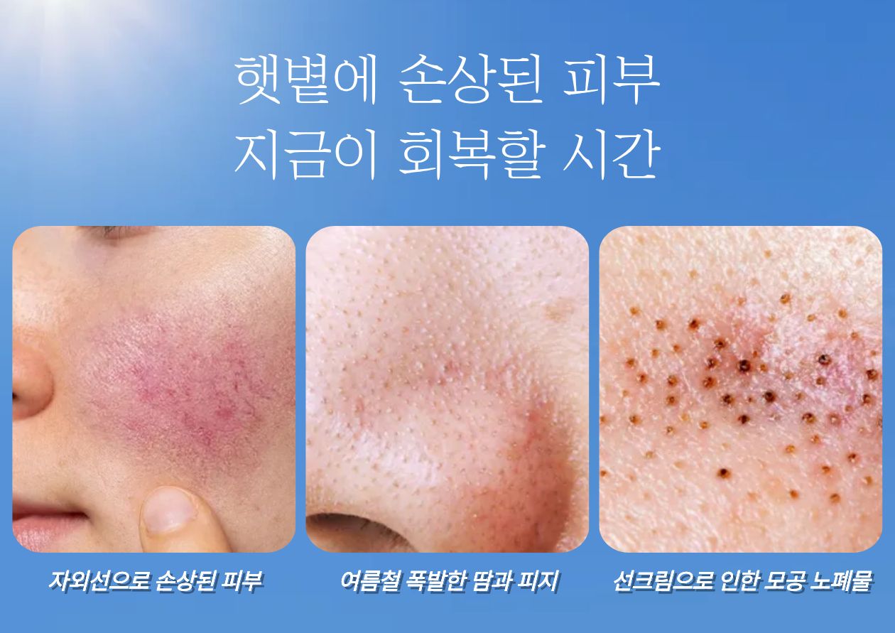 여름철손상된피부.jpg