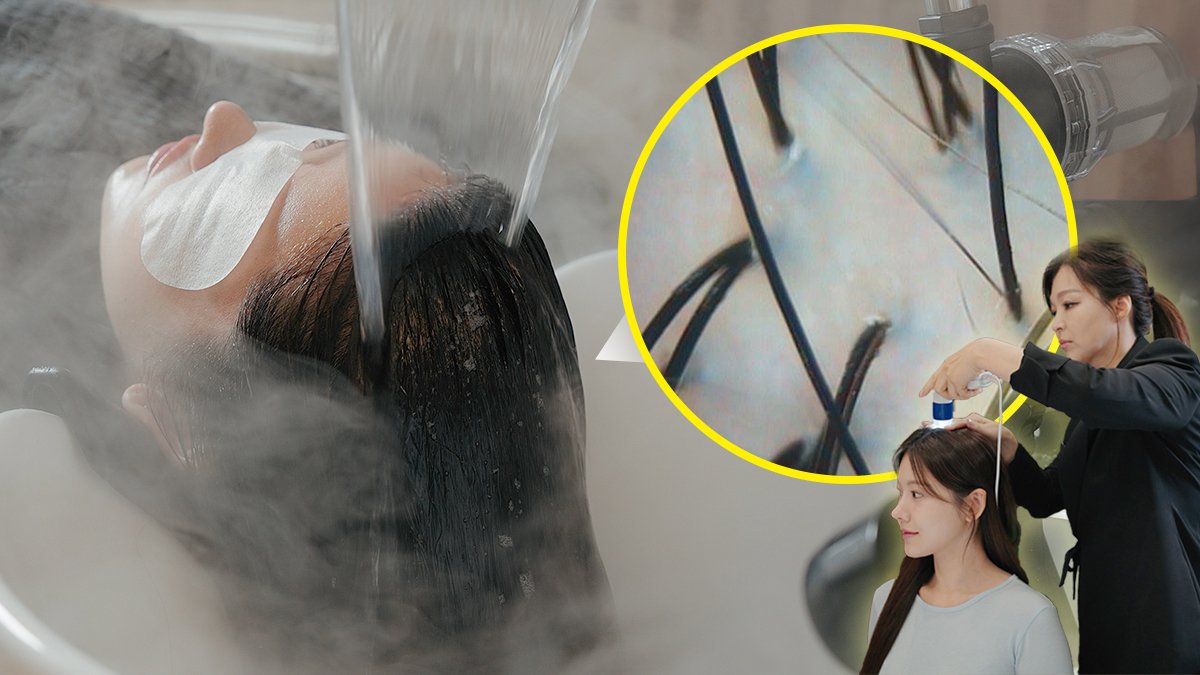 明星浓密秀发的秘诀！江南总店1:1定制护理头皮诊所