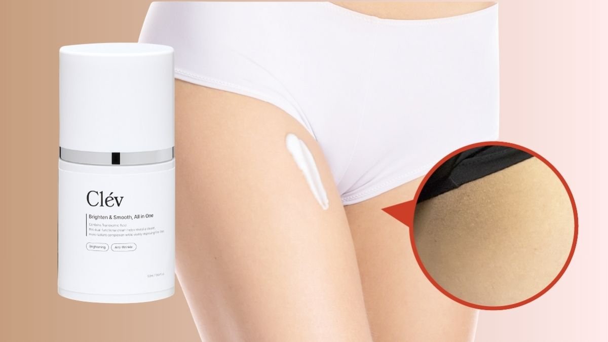 色素沉淀终结者｜为解决色素沉淀困扰，拥有6年化妆品MD经验的我亲自研发而成